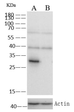 Invitrogen SULT1A1 Monoclonal Antibody (3C5H6) 100 &mu;L; Unconjugated:Antibodies,