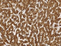 Invitrogen SULT1A1 Recombinant Rabbit Monoclonal Antibody (034) 100 &mu;L;