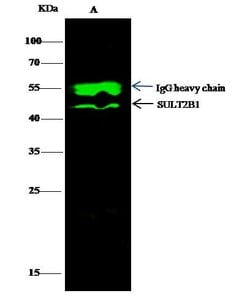 Invitrogen SULT2B1 Recombinant Rabbit Monoclonal Antibody (007) 100 &mu;L | Buy Online | Invitrogen&trade; | Fisher Scientific
