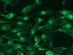 Invitrogen Transferrin Receptor Recombinant Rabbit Monoclonal Antibody (040) 100 &mu;L | Buy Online | Invitrogen&trade; | Fisher Scientific