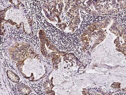 Invitrogen TIE1 Monoclonal Antibody (8D2D2) 100 &mu;L | Buy Online | Invitrogen&trade; | Fisher Scientific