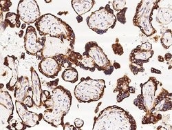 TNFAIP8 Monoclonal Antibody (01):Antibodies, Monoclonal