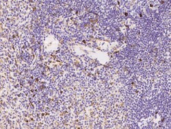 TNFAIP8 Monoclonal Antibody (01):Antibodies, Monoclonal