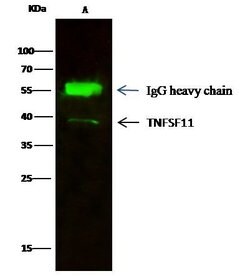 Invitrogen CD254 (RANK Ligand) Recombinant Rabbit Monoclonal Antibody (101) 100 &mu;L | Buy Online | Invitrogen&trade; | Fisher Scientific