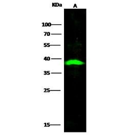 Invitrogen CD254 (RANK Ligand) Recombinant Rabbit Monoclonal Antibody (101) 100 &mu;L | Buy Online | Invitrogen&trade; | Fisher Scientific