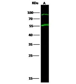 TPH1 Recombinant Rabbit Monoclonal Antibody (145):Antibodies, Recombinant