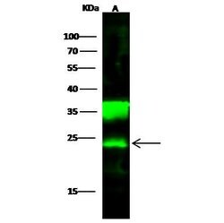 Invitrogen PGP9.5 Recombinant Rabbit Monoclonal Antibody (104) 100 &mu;L;