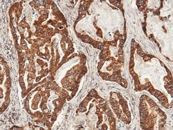 Invitrogen ULBP2 Recombinant Rabbit Monoclonal Antibody (022) 100 &mu;L;
