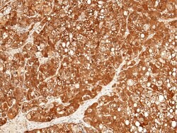 Invitrogen ULBP2 Recombinant Rabbit Monoclonal Antibody (022) 100 &mu;L;