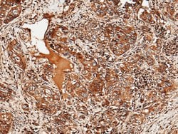Invitrogen ULBP2 Recombinant Rabbit Monoclonal Antibody (022) 100 &mu;L;
