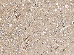 Invitrogen VAPB Recombinant Rabbit Monoclonal Antibody (103) 100 &mu;L;