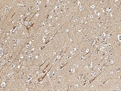 Invitrogen VAPB Recombinant Rabbit Monoclonal Antibody (103) 100 &mu;L;