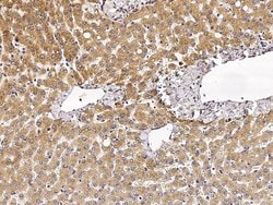 Invitrogen VAPB Recombinant Rabbit Monoclonal Antibody (103) 100 &mu;L;