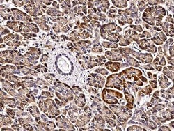 Invitrogen VAPB Recombinant Rabbit Monoclonal Antibody (103) 100 &mu;L;