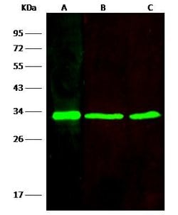 Invitrogen VAPB Recombinant Rabbit Monoclonal Antibody (208) 100 &mu;L;