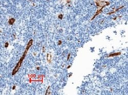 VWF Recombinant Rabbit Monoclonal Antibody (111):Antibodies, Recombinant