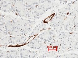 VWF Recombinant Rabbit Monoclonal Antibody (111):Antibodies, Recombinant