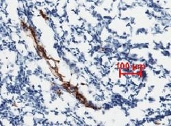 VWF Recombinant Rabbit Monoclonal Antibody (111):Antibodies, Recombinant