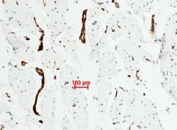 VWF Recombinant Rabbit Monoclonal Antibody (111):Antibodies, Recombinant