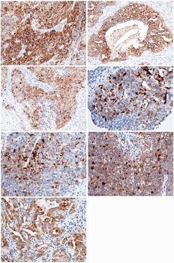 Invitrogen WFDC2 Recombinant Rabbit Monoclonal Antibody (404) 100 &mu;L;