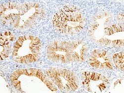 Invitrogen WFDC2 Recombinant Rabbit Monoclonal Antibody (404) 100 &mu;L;
