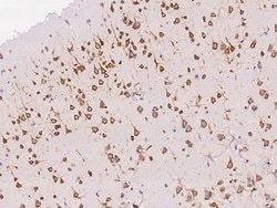 Invitrogen AGO2 Recombinant Rabbit Monoclonal Antibody (036) 100 &mu;L | Buy Online | Invitrogen&trade; | Fisher Scientific