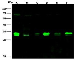 Invitrogen Bcl-xL Recombinant Rabbit Monoclonal Antibody (036) 100 &mu;L | Buy Online | Invitrogen&trade; | Fisher Scientific