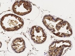 Invitrogen CaMKIV Recombinant Rabbit Monoclonal Antibody (001) 100 &mu;L;