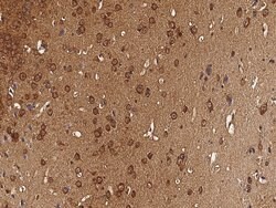 Invitrogen CaMKIV Recombinant Rabbit Monoclonal Antibody (001) 100 &mu;L;