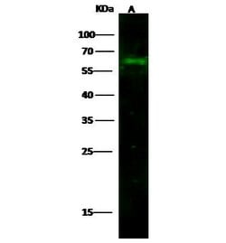 Invitrogen CD14 Recombinant Rabbit Monoclonal Antibody (2) 100 &mu;L; Unconjugated:Antibodies,