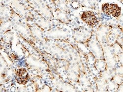 Invitrogen CD34 Recombinant Rabbit Monoclonal Antibody (013) 100 &mu;L;