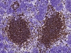 Invitrogen CD79b Recombinant Rabbit Monoclonal Antibody (003) 100 &mu;L;