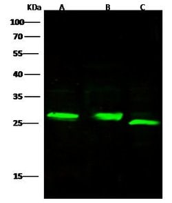 Invitrogen Complement Factor D Recombinant Rabbit Monoclonal Antibody (104)