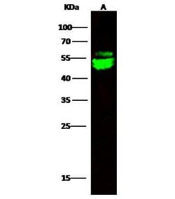 Invitrogen CNDP2 Recombinant Rabbit Monoclonal Antibody (001) 100 &mu;L;