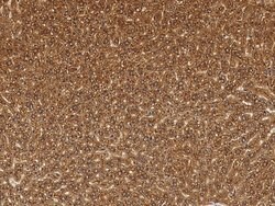 Invitrogen Cathepsin B Recombinant Rabbit Monoclonal Antibody (010) 100 &mu;L | Buy Online | Invitrogen&trade; | Fisher Scientific