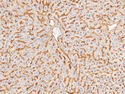 Invitrogen CAR Recombinant Rabbit Monoclonal Antibody (001) 100 &mu;L | Buy Online | Invitrogen&trade; | Fisher Scientific