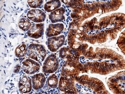 Invitrogen EpCAM Recombinant Rabbit Monoclonal Antibody (002) 100 &mu;L;