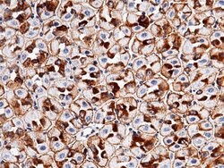 Invitrogen EpCAM Recombinant Rabbit Monoclonal Antibody (002) 100 &mu;L;