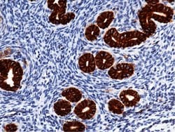 Invitrogen EpCAM Recombinant Rabbit Monoclonal Antibody (002) 100 &mu;L;
