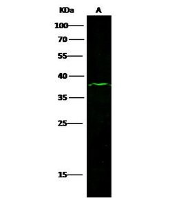 Invitrogen EpCAM Recombinant Rabbit Monoclonal Antibody (002) 100 &mu;L;