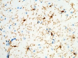 Invitrogen CD64 Recombinant Rabbit Monoclonal Antibody (1) 100 &mu;L | Buy Online | Invitrogen&trade; | Fisher Scientific