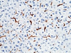 Invitrogen CD64 Recombinant Rabbit Monoclonal Antibody (1) 100 &mu;L | Buy Online | Invitrogen&trade; | Fisher Scientific