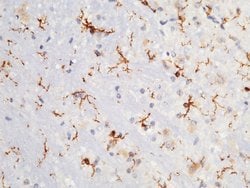 Invitrogen CD64 Recombinant Rabbit Monoclonal Antibody (008) 100 &mu;L;
