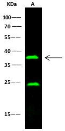 Invitrogen CD16/CD32 Recombinant Rabbit Monoclonal Antibody (015) 100 &mu;L | Buy Online | Invitrogen&trade; | Fisher Scientific