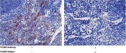 Invitrogen CD16-2 Recombinant Rabbit Monoclonal Antibody (011) 100 &mu;L;