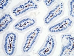 Invitrogen CD16-2 Recombinant Rabbit Monoclonal Antibody (011) 100 &mu;L;