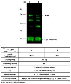 Invitrogen E-cadherin Recombinant Rabbit Monoclonal Antibody (117) 100 &mu;L | Buy Online | Invitrogen&trade; | Fisher Scientific
