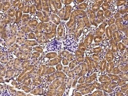 Invitrogen Growth Hormone Receptor Recombinant Rabbit Monoclonal Antibody