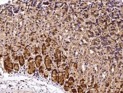 Invitrogen Growth Hormone Receptor Recombinant Rabbit Monoclonal Antibody