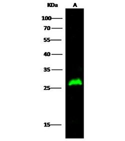 Invitrogen 15-PGDH Recombinant Rabbit Monoclonal Antibody (101) 100 &mu;L;